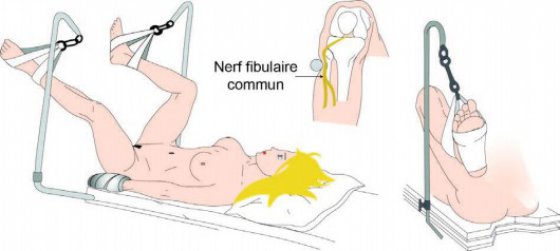 L'une des illustrations du Manuel pratique d'anesthésie suisse incriminé. ©DR